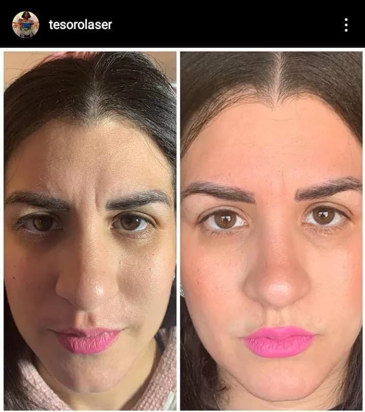 Tesoro Laser & Skin Care Inc