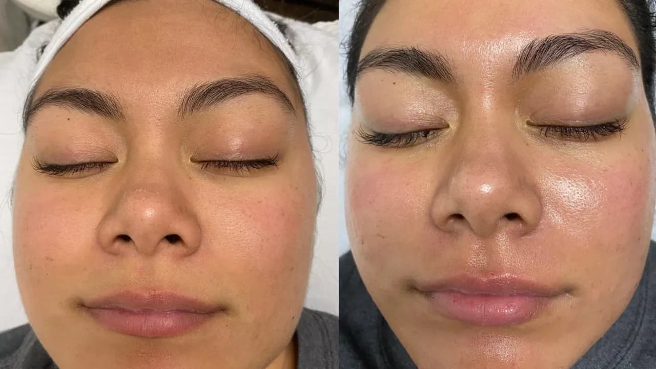 Custom Facial