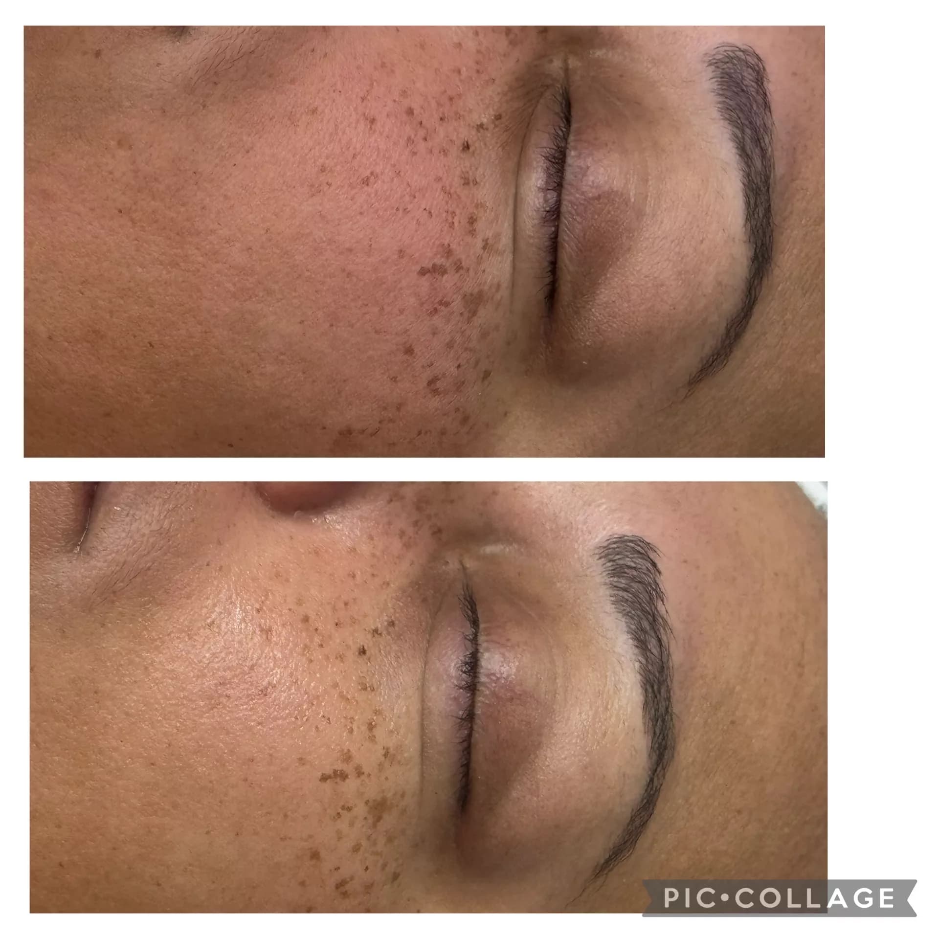 Radiance Facial
