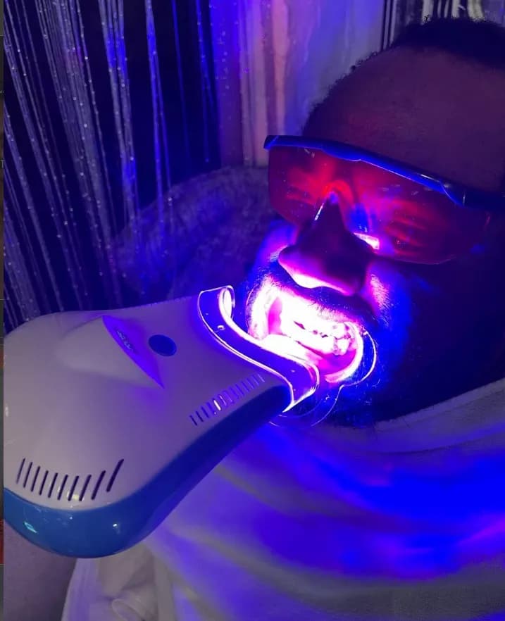 Teeth Whitening - Illuminate Your Face