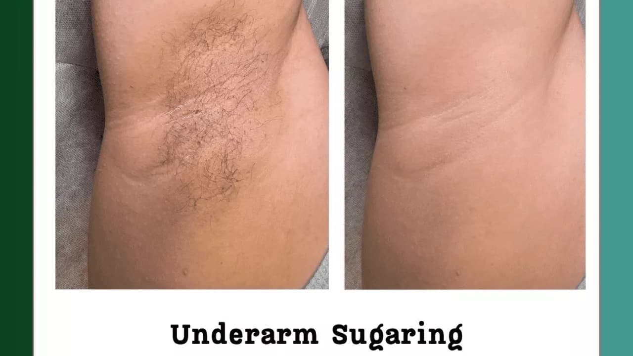 Underarm Sugaring